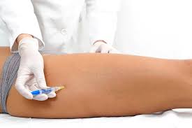 Mesoterapia redutora ou reafirmante localizada
